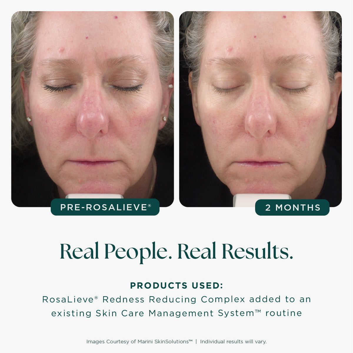 Marini Skinsolutions Rosalieve Redness Reducing Complex